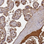 Immunohistochemical staining of human placenta shows strong positivity in plasma.