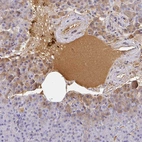 Immunohistochemical staining of human pancreas shows strong positivity in plasma.