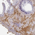 Immunohistochemical staining of human prostate shows strong positivity in plasma.