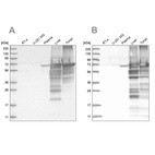 Western blot analysis using Anti-ALB antibody HPA031024 (A) shows similar pattern to independent antibody HPA031025 (B).