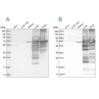 Western blot analysis using Anti-ALB antibody HPA031024 (A) shows similar pattern to independent antibody HPA031025 (B).