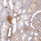 Immunohistochemical staining of human kidney shows strong positivity in plasma.