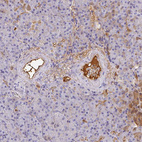 Immunohistochemical staining of human pancreas shows strong positivity in plasma.