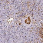 Immunohistochemical staining of human pancreas shows strong positivity in plasma.