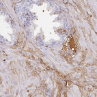 Immunohistochemical staining of human prostate shows strong positivity in plasma.