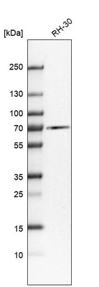 Western blot analysis in human cell line RH-30.