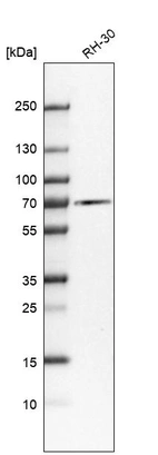 Western blot analysis in human cell line RH-30.