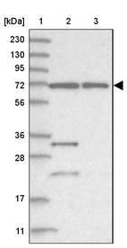 Lane 1: Marker [kDa] 230, 130, 95, 72, 56, 36, 28, 17, 11_br/_Lane 2: Human cell line RT-4_br/_Lane 3: Human cell line U-251MG sp