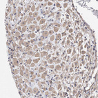 Anti-AOC1 Antibody