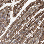 Immunohistochemical staining of human duodenum shows strong membranous positivity in glandular cells.