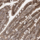 Immunohistochemical staining of human duodenum shows strong membranous positivity in glandular cells.