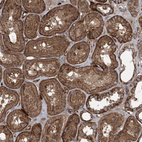 Immunohistochemical staining of human kidney shows strong membranous positivity in cells in tubules.
