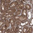 Immunohistochemical staining of human kidney shows strong membranous positivity in cells in tubules.