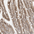 Immunohistochemical staining of human duodenum shows moderate to strong membranous positivity in glandular cells.