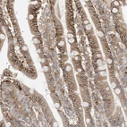 Immunohistochemical staining of human duodenum shows moderate to strong membranous positivity in glandular cells.