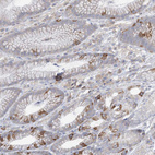 Immunohistochemical staining of human stomach shows moderate to strong membranous positivity in glandular cells.