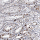 Immunohistochemical staining of human stomach shows moderate to strong membranous positivity in glandular cells.