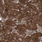 Anti-PHF1 Antibody