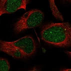 Immunofluorescent staining of human cell line U-2 OS shows localization to nucleoplasm.