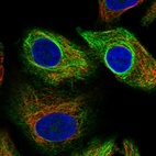 Immunofluorescent staining of human cell line A549 shows localization to cytosol & intermediate filaments.