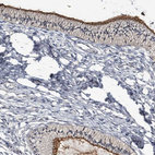Immunohistochemical staining of human cervix shows strong membranous positivity in glandular cells.