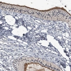 Immunohistochemical staining of human cervix shows strong membranous positivity in glandular cells.