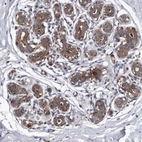 Immunohistochemical staining of human breast shows moderate to strong membranous and cytoplasmic positivity in glandular cells.