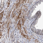 Immunohistochemical staining of human prostate shows moderate cytoplasmic positivity in smooth muscle cells.