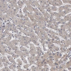 Immunohistochemical staining of human liver shows no positivity in hepatocytes as expected.