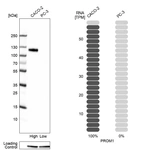Western blot analysis in human cell line CACO-2 and human cell line PC-3.