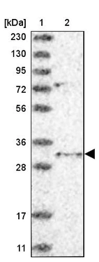 Lane 1: Marker [kDa] 230, 130, 95, 72, 56, 36, 28, 17, 11_br/_Lane 2: Human cell line RT-4