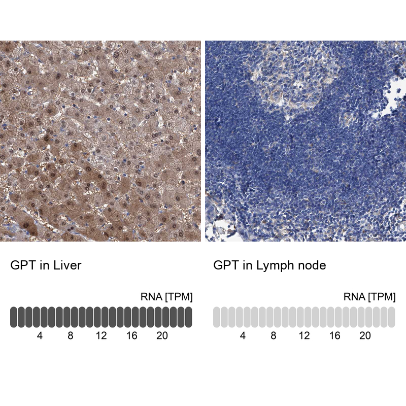Anti-GPT Antibody