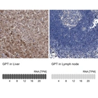 Anti-GPT Antibody