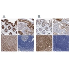 Immunohistochemical staining of human colon, kidney, liver and lymph node using Anti-GPT antibody HPA031059 (A) shows similar protein distribution across tissues to independent antibody HPA031060 (B).