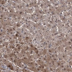 Immunohistochemical staining of human liver shows moderate cytoplasmic positivity in hepatocytes.
