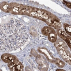 Immunohistochemical staining of human kidney shows moderate to strong cytoplasmic positivity in cells in tubules.
