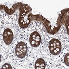 Immunohistochemical staining of human colon shows strong cytoplasmic positivity in glandular cells.