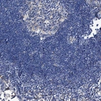 Immunohistochemical staining of human lymph node shows no positivity in non-germinal center cells as expected.
