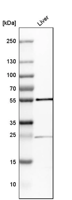 Western blot analysis in human liver tissue.