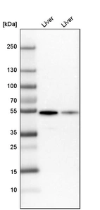 Western blot analysis in mouse liver tissue and rat liver tissue.
