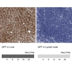 Anti-GPT Antibody