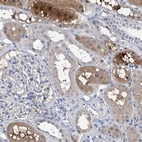Immunohistochemical staining of human kidney shows moderate to strong cytoplasmic positivity in cells in tubules.