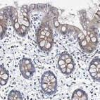 Immunohistochemical staining of human colon shows moderate cytoplasmic positivity in glandular cells.