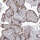 Immunohistochemical staining of human placenta shows moderate cytoplasmic positivity in trophoblastic cells.