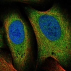 Immunofluorescent staining of human cell line U-2 OS shows localization to cytosol.