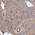 Anti-KCNJ8 Antibody