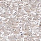 Immunohistochemical staining of human heart muscle shows weak cytoplasmic positivity in cardiomyocytes.