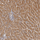 Immunohistochemical staining of human liver shows strong cytoplasmic positivity in hepatocytes.
