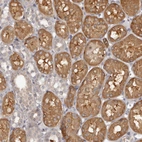 Immunohistochemical staining of human kidney shows strong cytoplasmic positivity in cells in tubules.