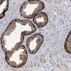 Anti-PYGB Antibody